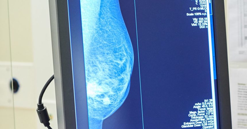 Tumore al seno, Europa Donna “Test genomici non ancora rimborsati”
