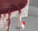 Carenza di 650 unità di sangue in Italia