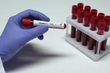 Screening HCV, stanziati 71,5 milioni