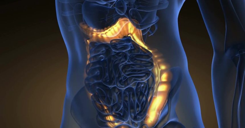 Tumore del colon: microbiota responsabile delle metastasi al fegato