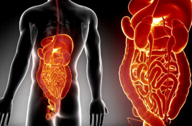 Cresce l’incidenza delle malattie infiammatorie croniche intestinali